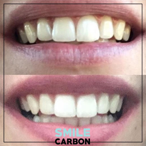 Charbon Actif Blanchisseur de dents naturel de Smile Carbon